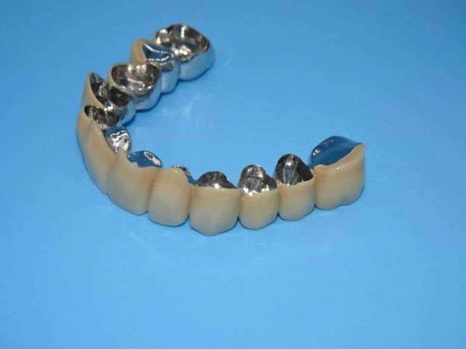 Eine Zahnprothese mit goldenen und silbernen Zähnen auf blauem Hintergrund