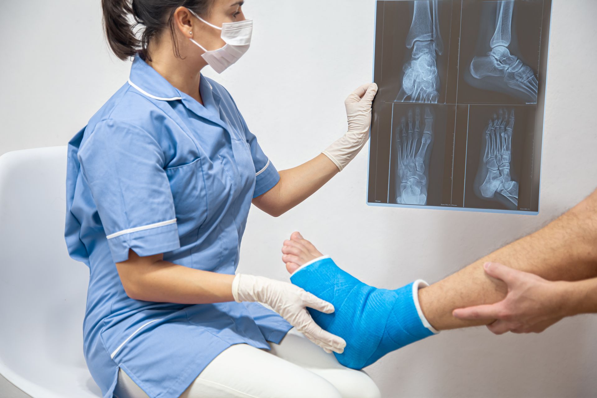 Radiographies d'une fracture au pied