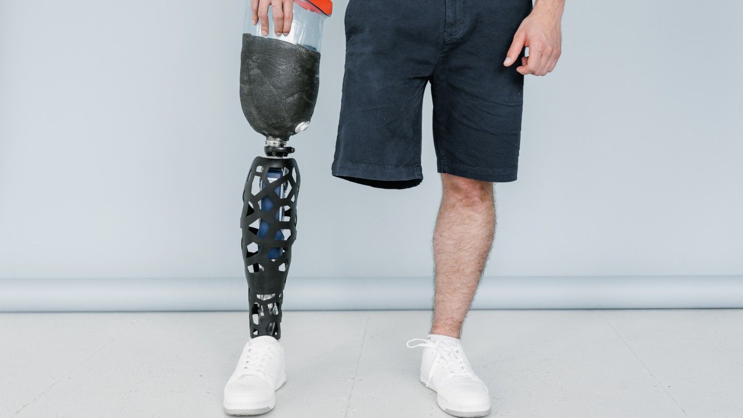 Persona de pie con una prótesis en la pierna izquierda, vestida con pantalones