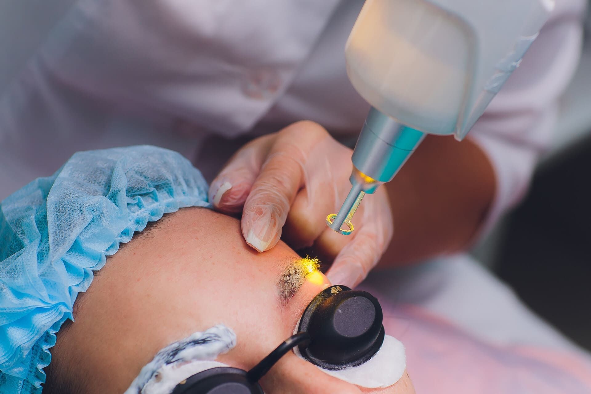 Una mujer está recibiendo un tratamiento con láser en sus cejas.