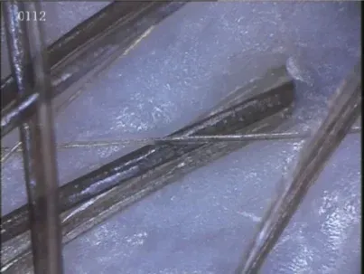 Un primer plano del cabello de una persona bajo un microscopio.