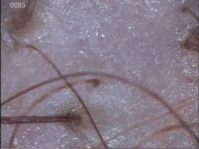 Un primer plano del cabello de una persona bajo un microscopio.