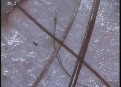 Un primer plano del cabello de una persona bajo un microscopio.