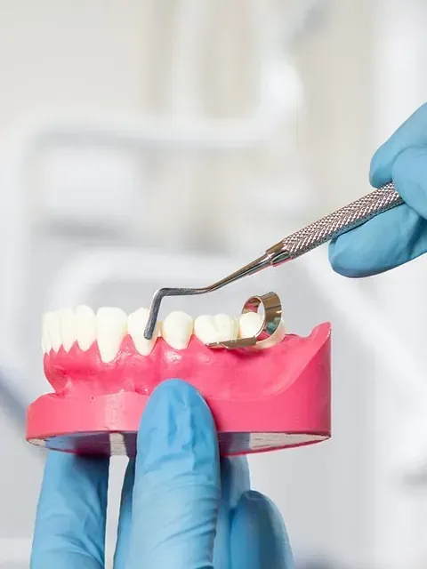 Una persona con guantes azules está examinando un modelo de dientes.