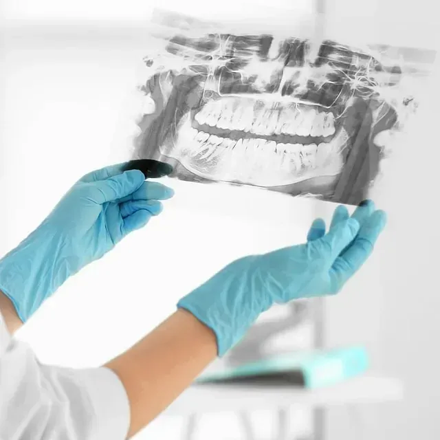 Una persona que lleva guantes azules sostiene una radiografía de los dientes de una persona.