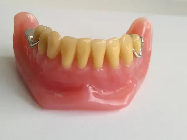 Un primer plano de una dentadura postiza con dientes sobre una superficie blanca.