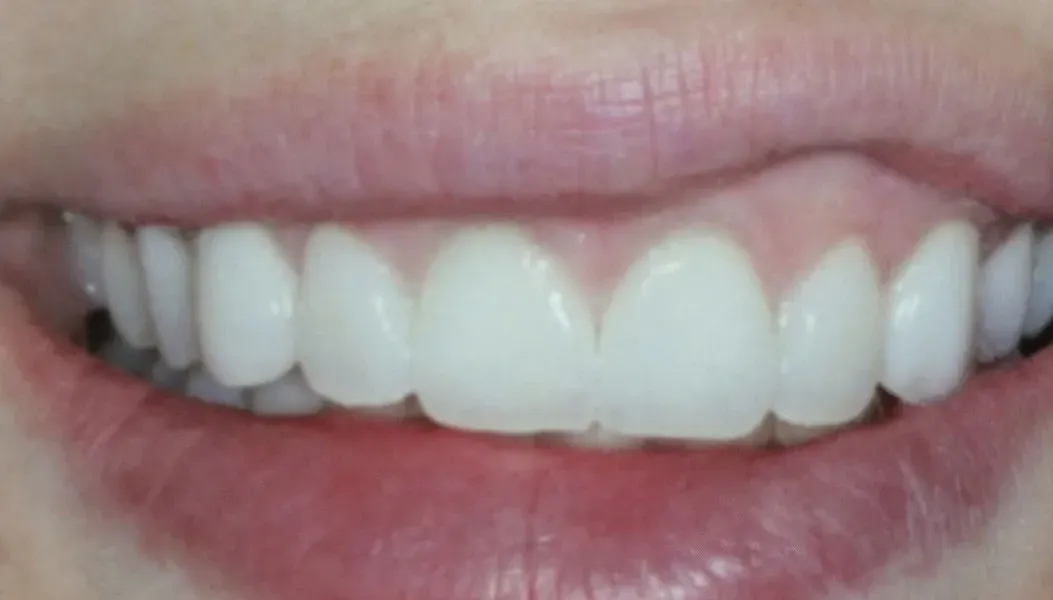 Un primer plano de la sonrisa de una mujer con dientes blancos.