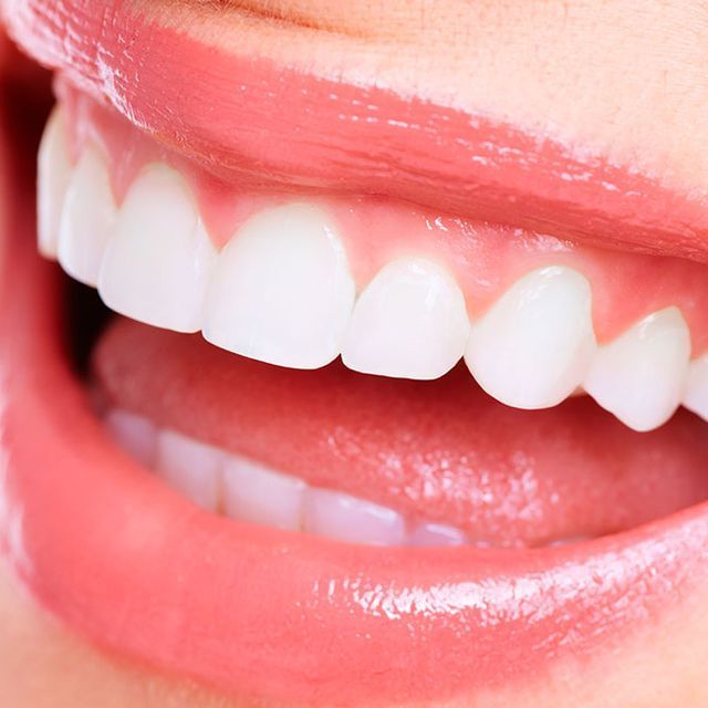 Un primer plano de la boca de una mujer con dientes blancos y labios rosados.