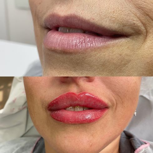 Una mujer se está haciendo un tatuaje de maquillaje permanente en los labios.