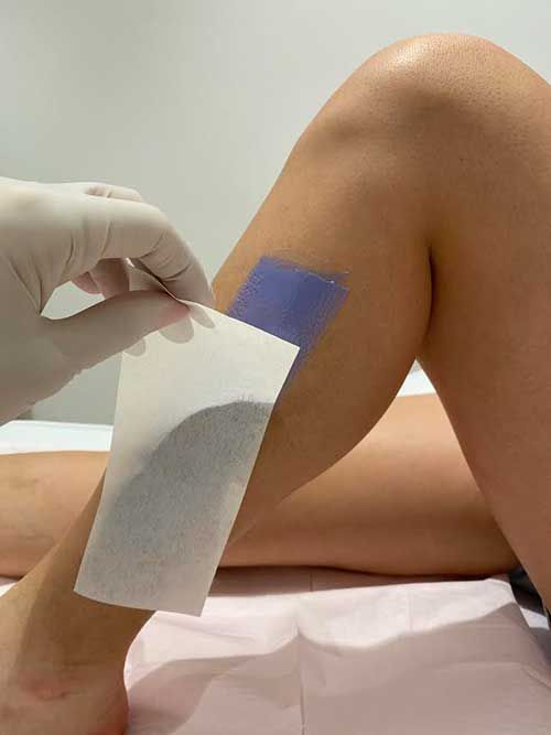 Αποτρίχωση SUGAR nails & coctails