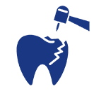 Grafik für Zahn mit Beschädigung und Bohrer