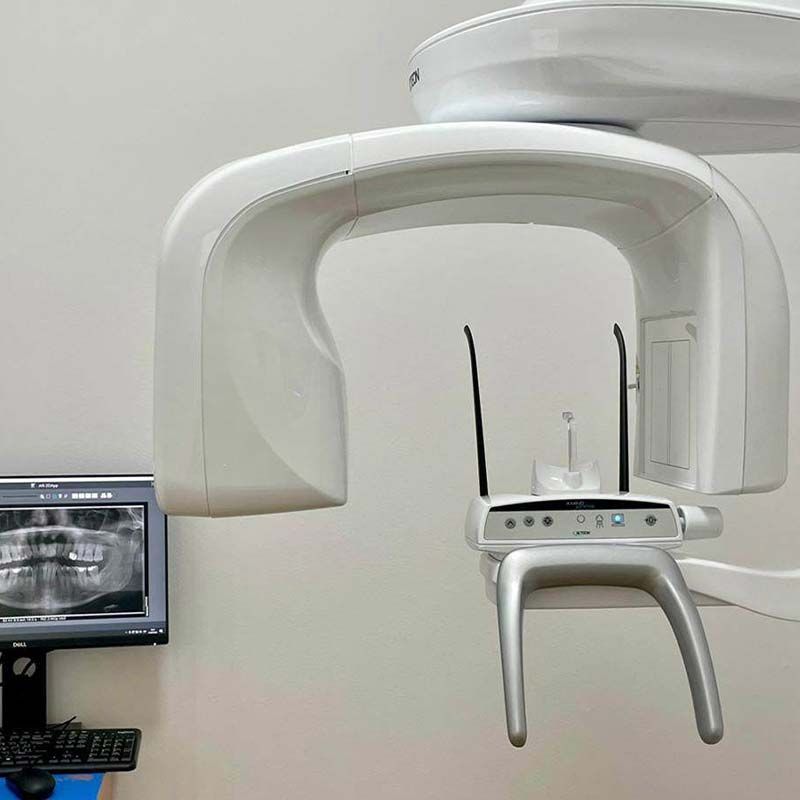 Una máquina de rayos X dental está colgada en una pared al lado de un monitor.