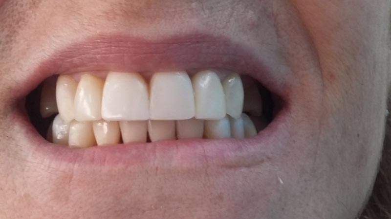 Un primer plano de la boca de una persona con dientes blancos.