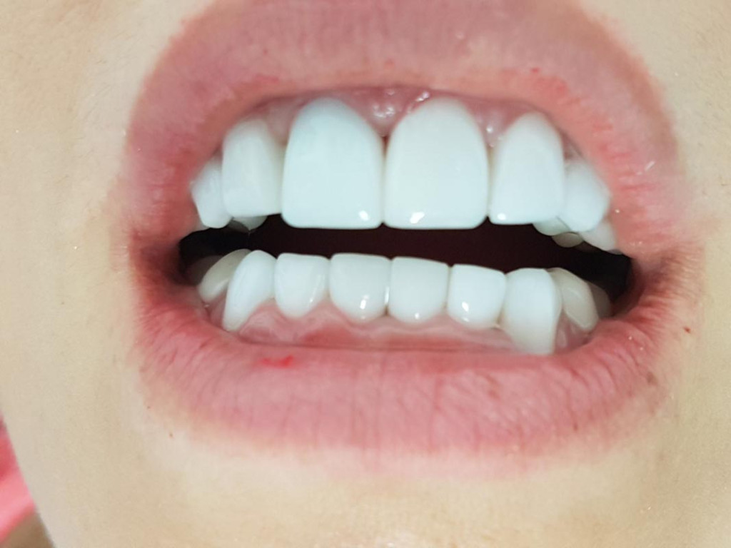 Un primer plano de la boca de una persona con dientes blancos.