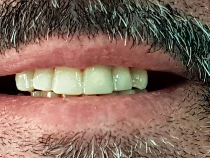 Un primer plano de la boca de un hombre con barba y dientes blancos.