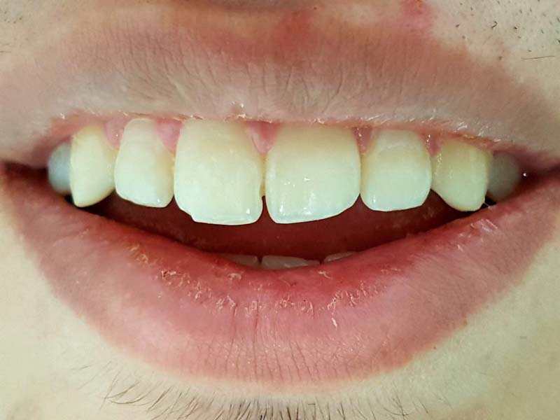 Un primer plano de la boca de un hombre con dientes blancos y labios rojos.