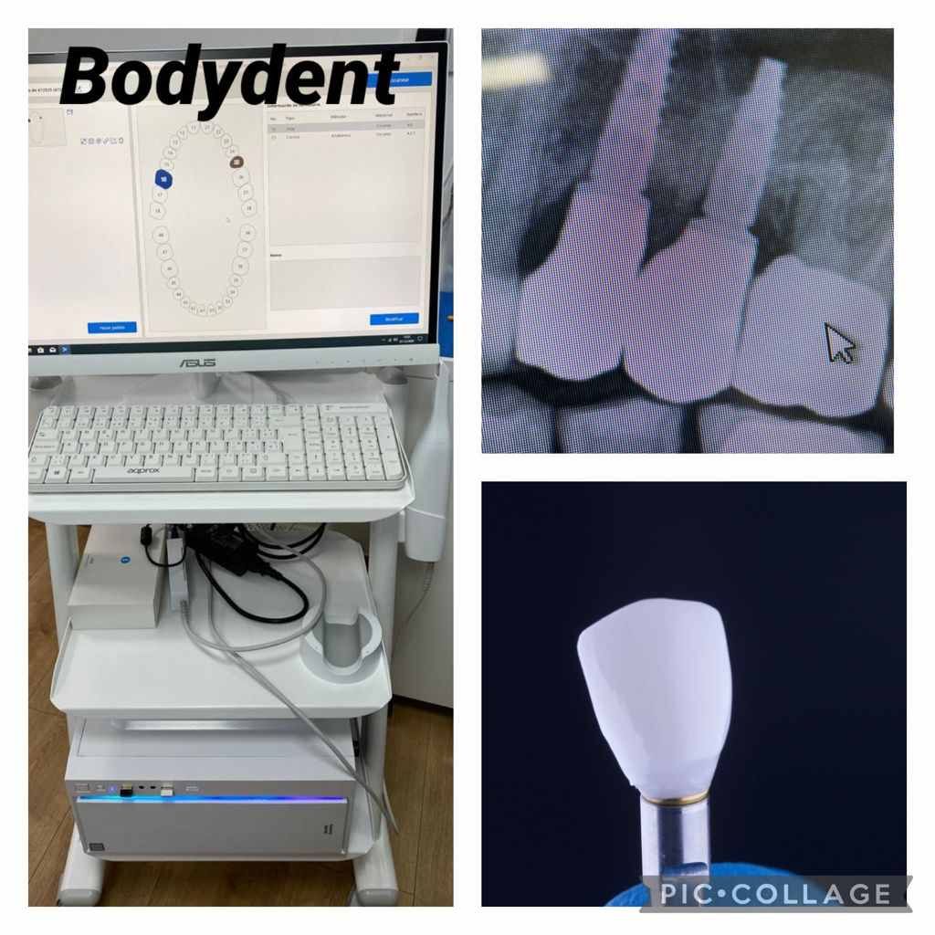 Una computadora con la palabra bodydent en ella
