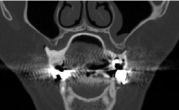 Una fotografía de antes y después de los dientes de una persona.