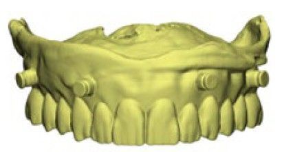 Un primer plano de la boca de un hombre con barba y dientes blancos.