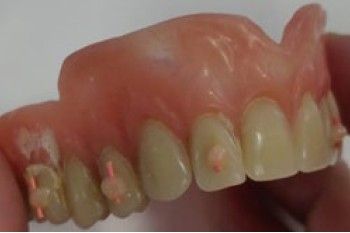 Un primer plano de la boca de un hombre con barba y dientes faltantes.