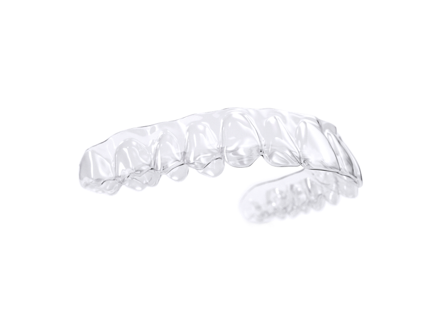 Un primer plano de la boca de una mujer con aparatos dentales.