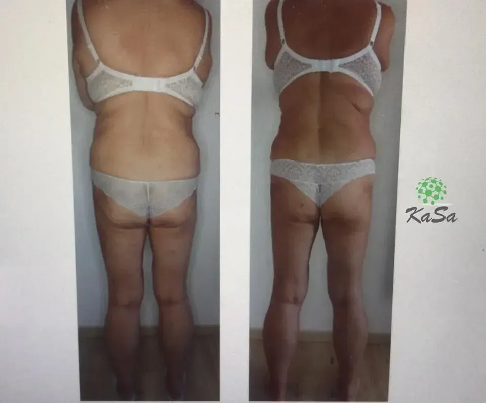 Vorher-Nachher-Frauenkörper von hinten, Fitness Hempel