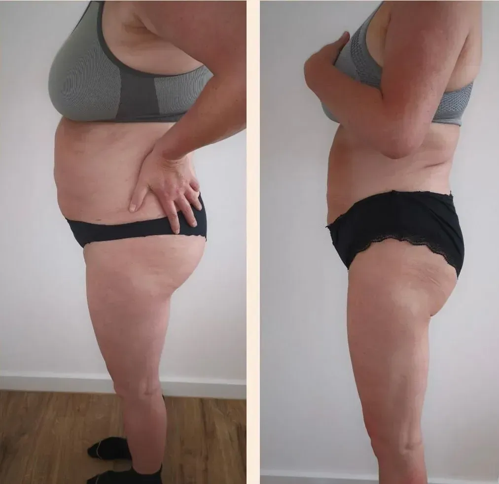 Vorher-Nachher-Frauenkörper von der Seite, Fitness Hempel