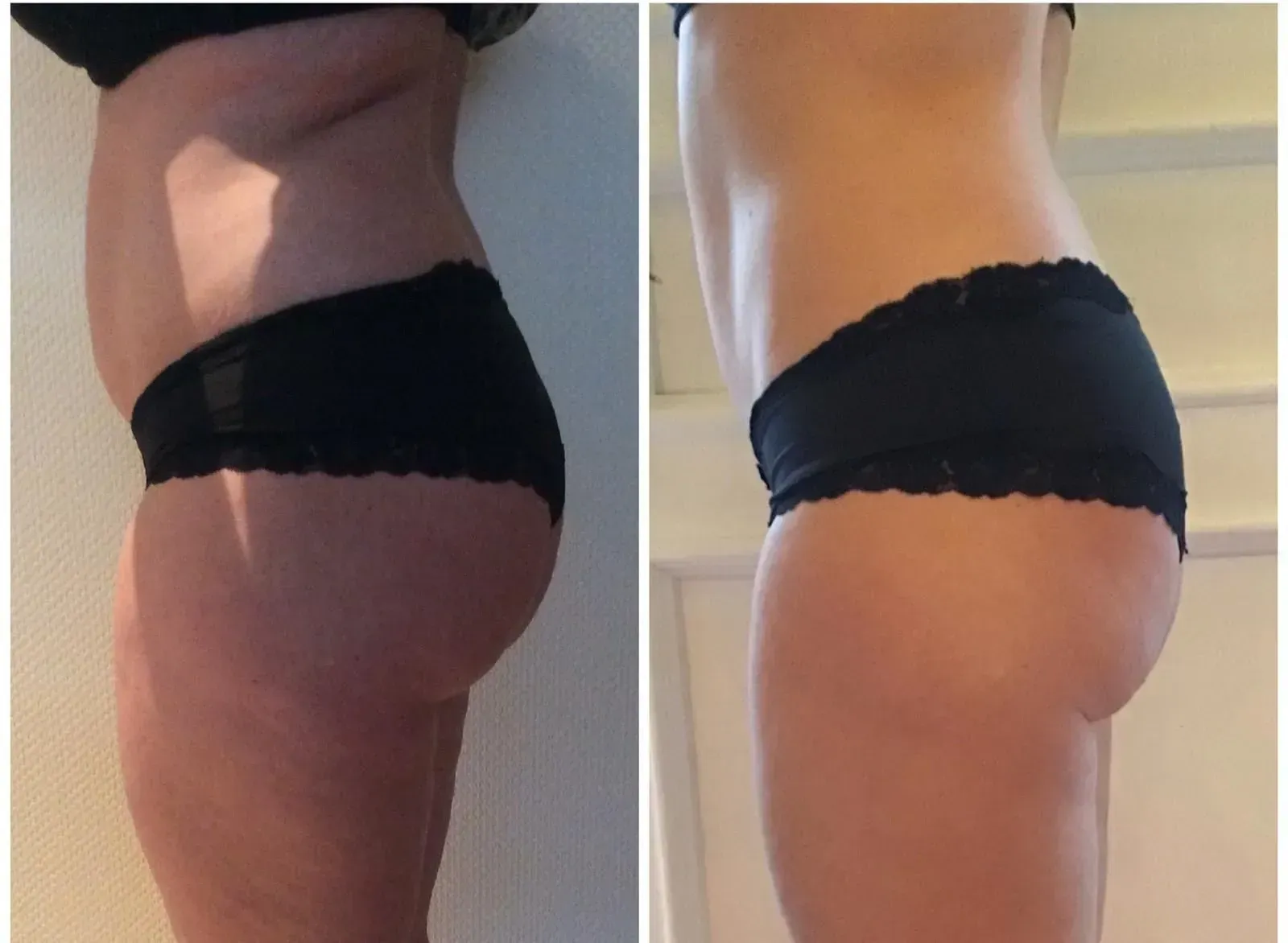 Vorher-Nachher-Frauenkörper von der Seite, Fitness Hempel