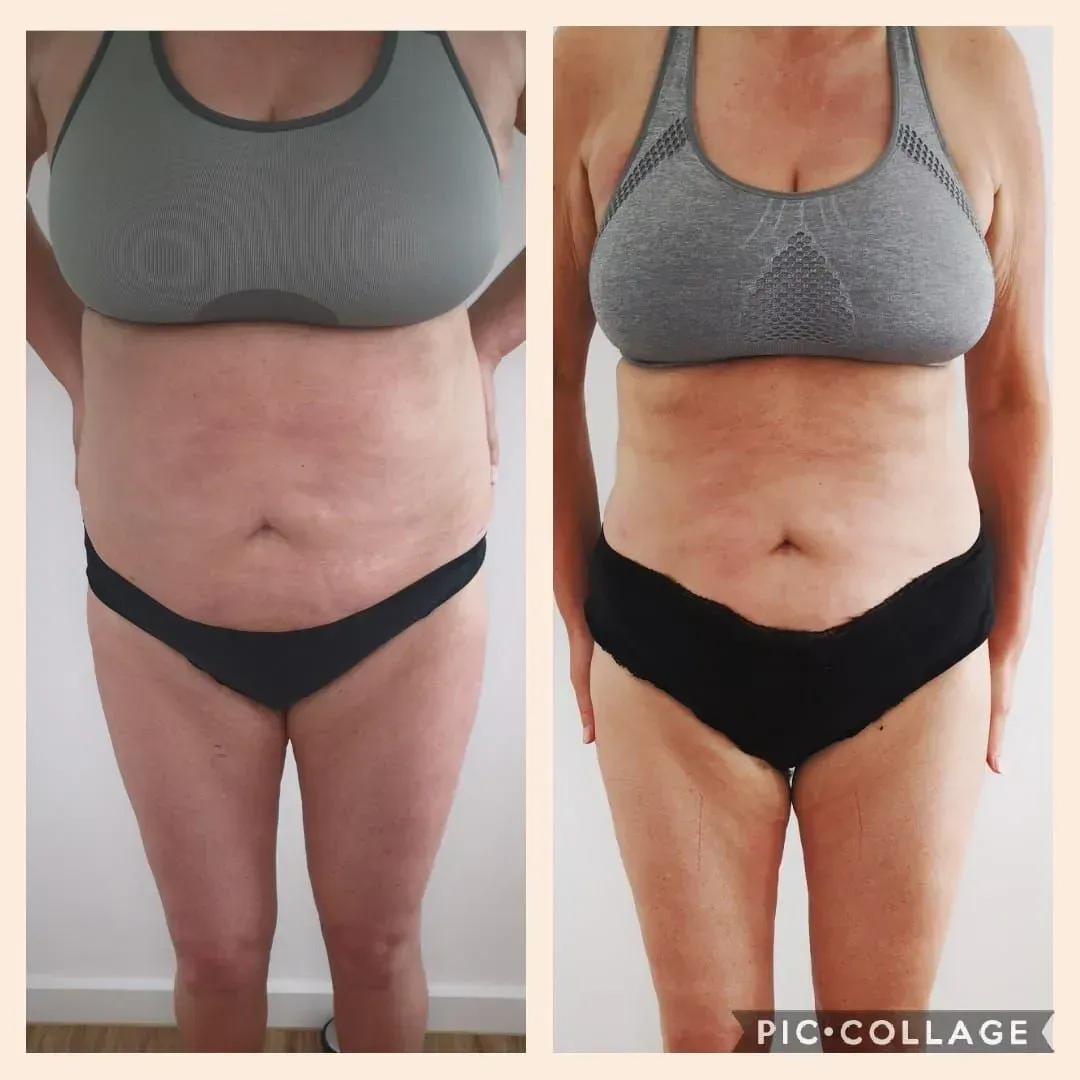 Vorher-Nachher-Frauenkörper von vorne, Fitness Hempel