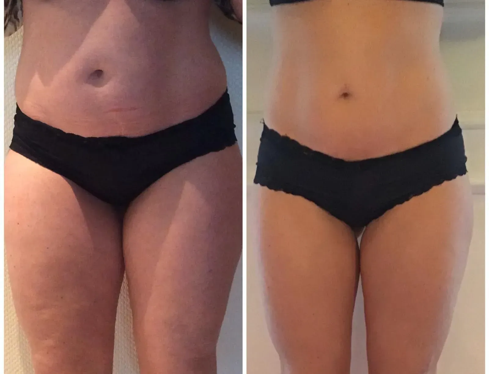 Vorher-Nachher-Frauenkörper von vorne, Fitness Hempel