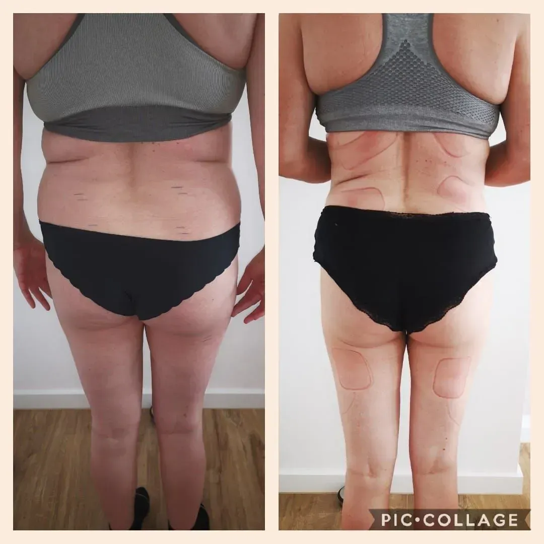 Vorher-Nachher-Frauenkörper von hinten, Fitness Hempel