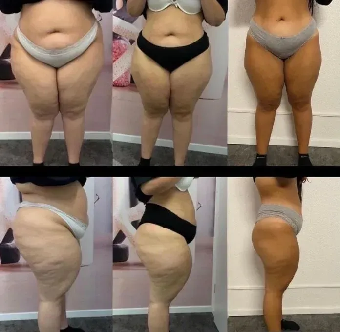 Vorher-Nachher-Frauenkörper von vorne und von der Seite, Fitness Hempel