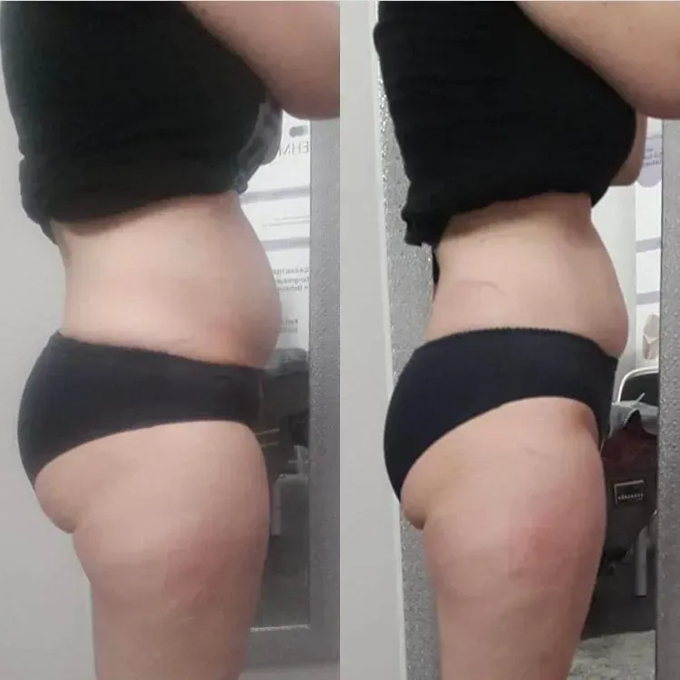 Vorher-Nachher-Frauenkörper von der Seite, Fitness Hempel