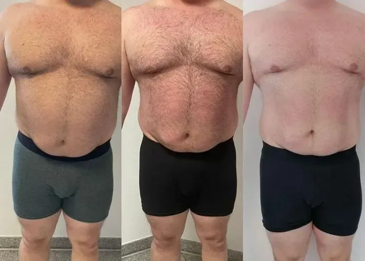 Vorher-Nachher-Männerkörper von der Seite, Fitness Hempel