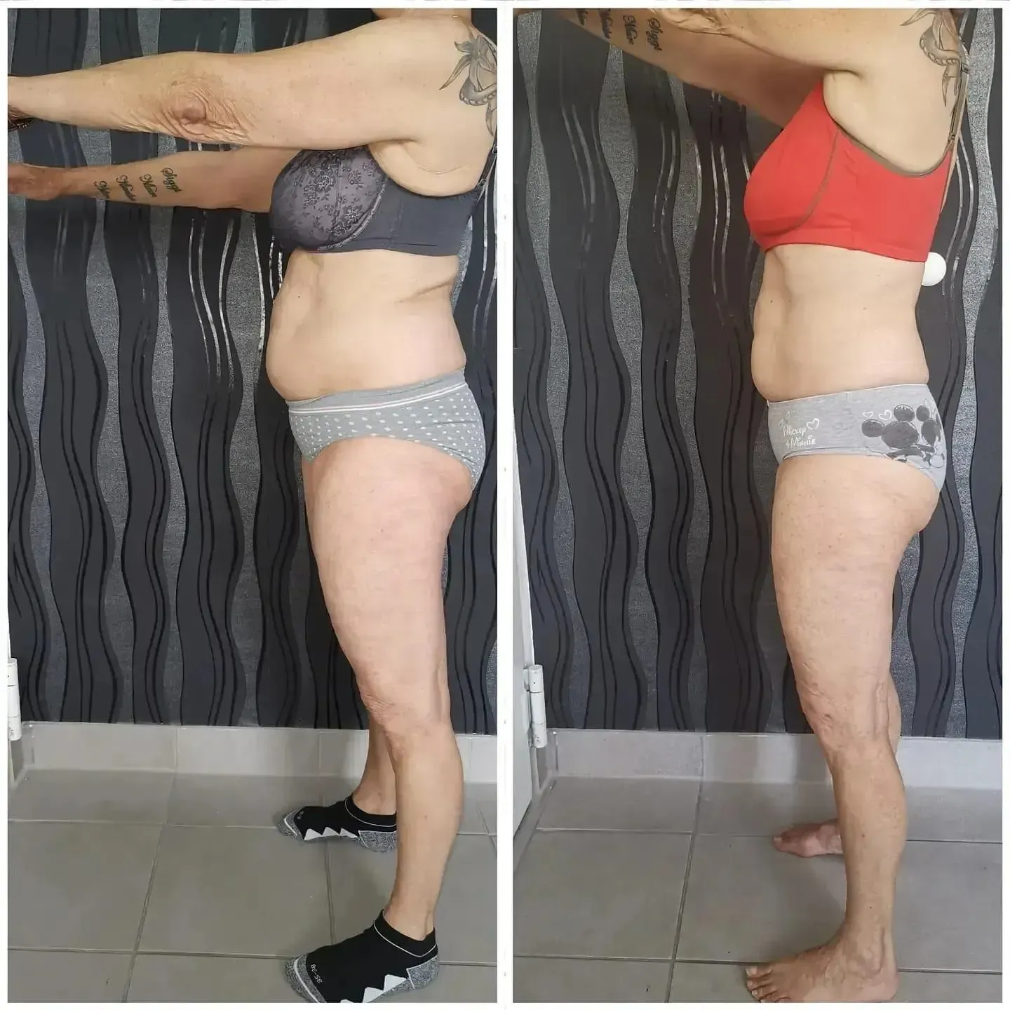 Vorher-Nachher-Frauenkörper von der Seite, Fitness Hempel