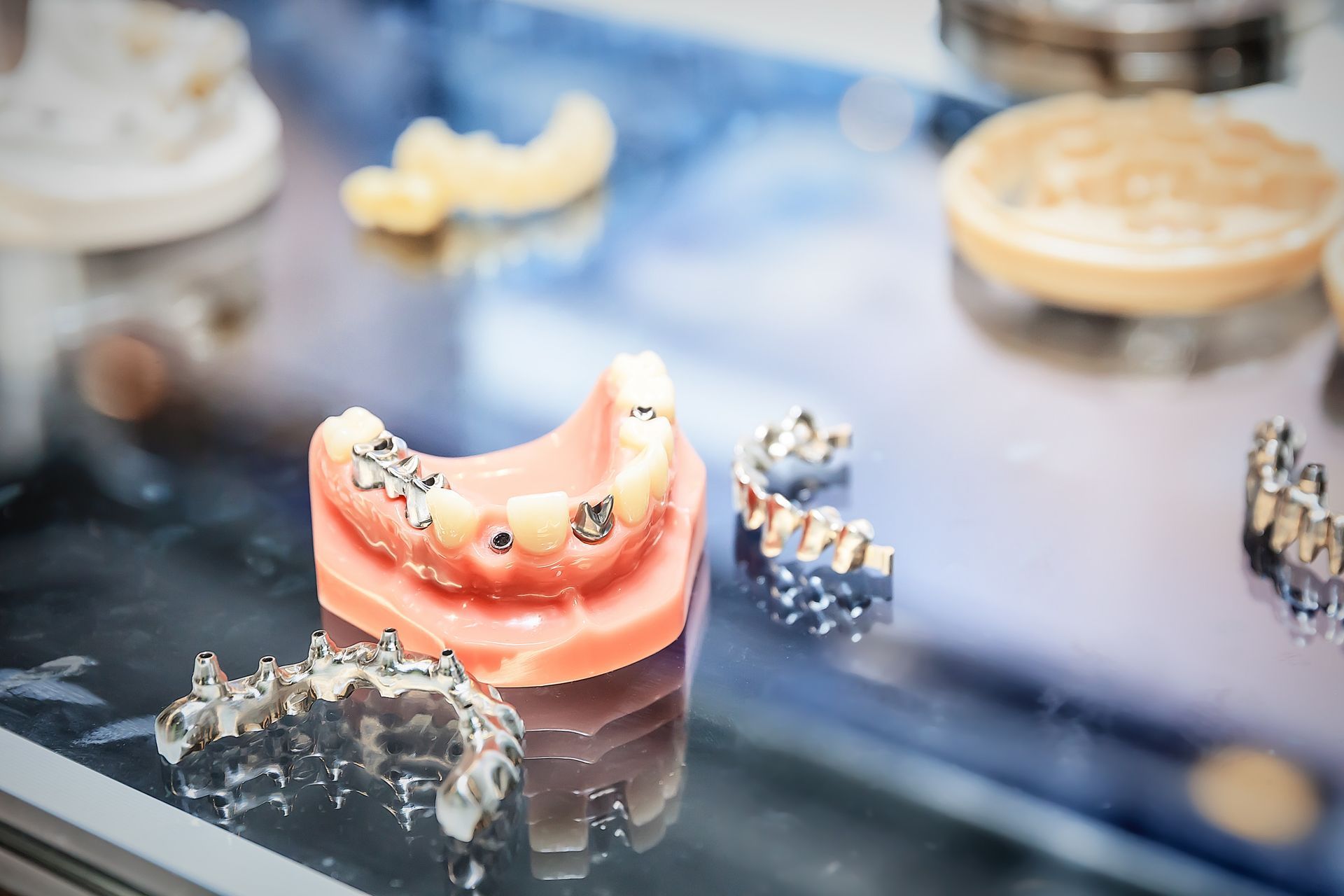 Implantes dentales y modelos de dientes en exposición.