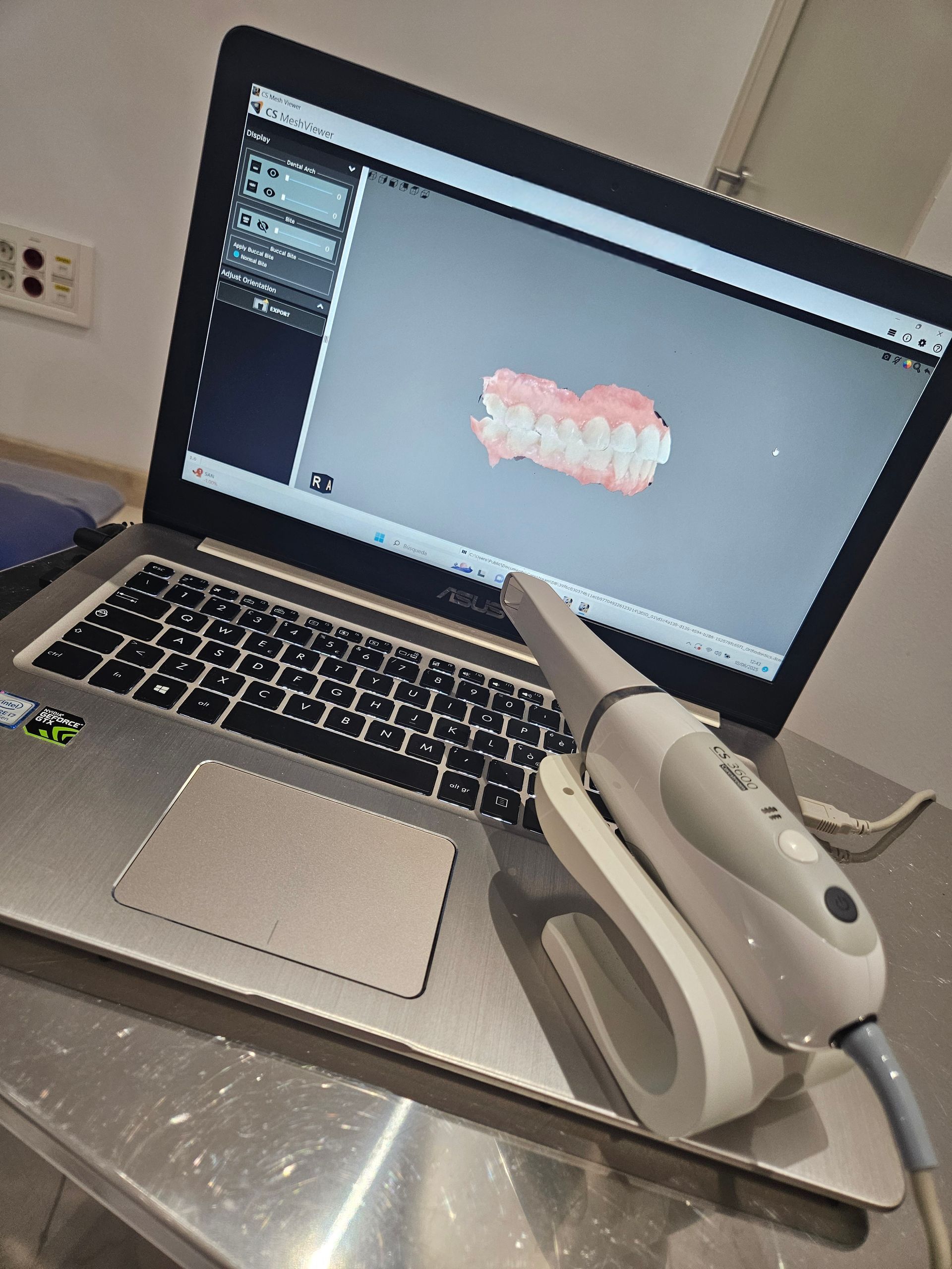 Computadora portátil que muestra un escaneo dental en 3D, con un escáner de mano al lado sobre una mesa de acero inoxidable.