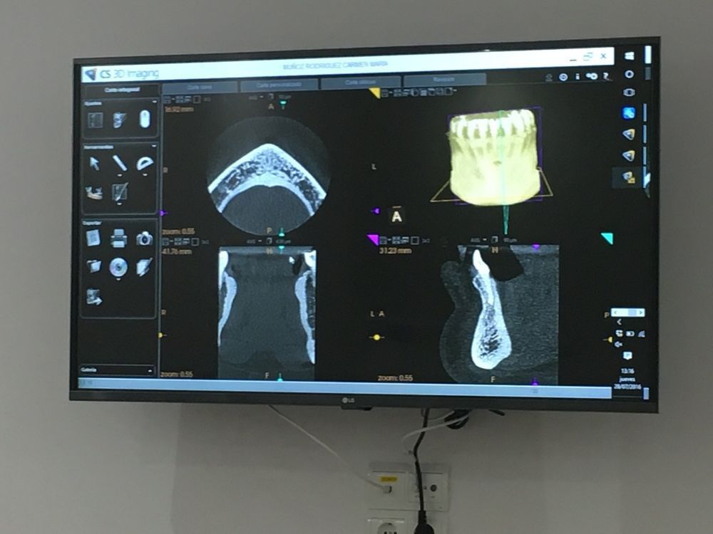 Dentista comparando muestras de color de dientes con los dientes del paciente, en el consultorio.