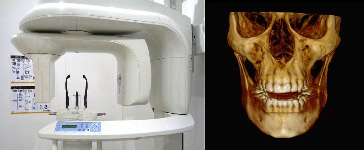 Máquina de rayos X dental junto a una representación 3D de un cráneo humano, que muestra los dientes y la estructura ósea.