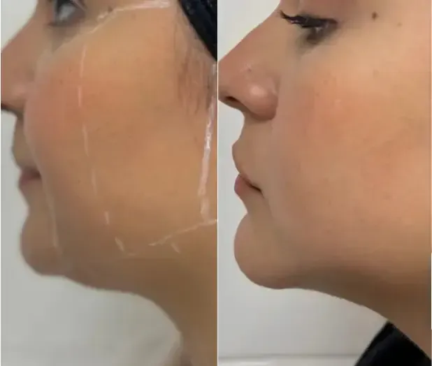 Una persona con un lirio en el pelo recibe un relajante masaje de espalda mientras está tumbada en una camilla blanca.