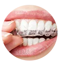 Un primer plano de un diente con un implante dental.