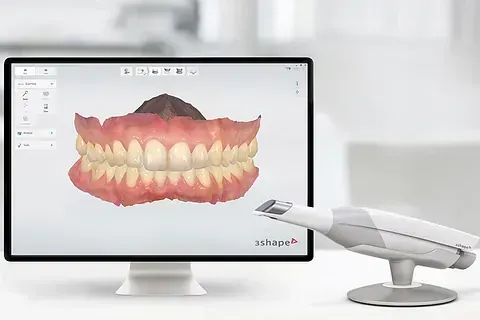 Un monitor de computadora con una imagen de los dientes de una persona.