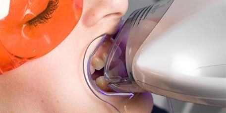 Eine Frau lässt sich in einer Zahnarztpraxis die Zähne aufhellen.