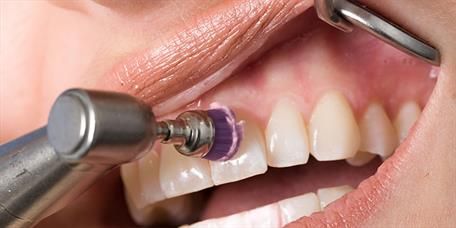 Eine Frau lässt sich beim Zahnarzt die Zähne reinigen.