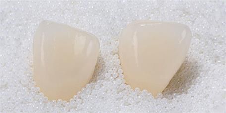 Zwei Zahnkronen liegen auf einem Haufen weißer Perlen.