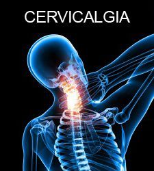 Ilustración médica azul de dolor de cuello, con la columna cervical resaltada en rojo y la palabra «CERVICALGIA» en la parte superior
