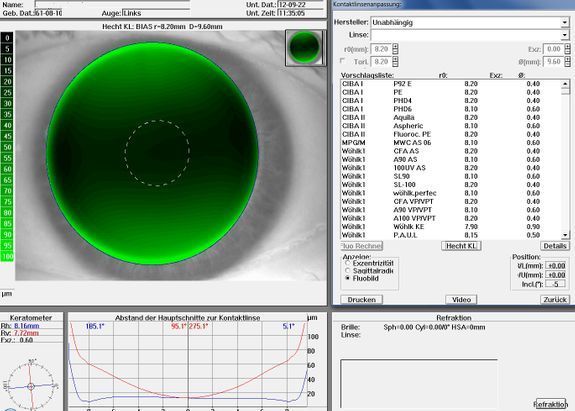 lentille semi-rigide correction astigmatisme - Bull'Optic SA