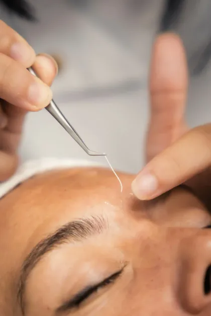Unas pinzas aplicando un hilo fino a la ceja de una persona durante un tratamiento cosmético
