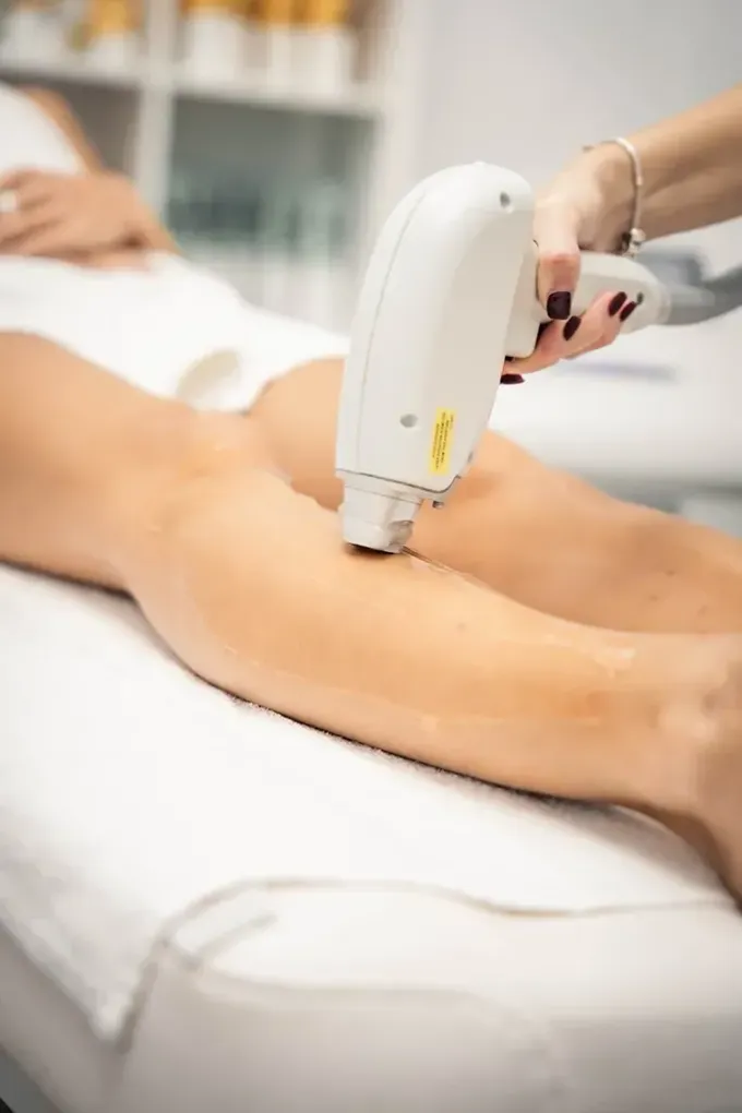 Persona recibiendo un tratamiento de depilación láser en la pierna en una clínica estética