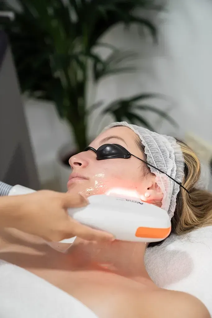 Persona recibiendo un tratamiento facial con un dispositivo de mano mientras lleva gafas protectoras y una cinta para el pelo